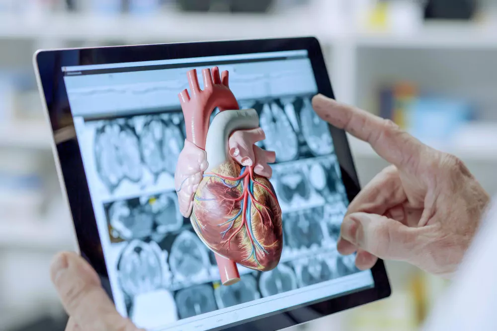Cardiac Electrophysiology Study